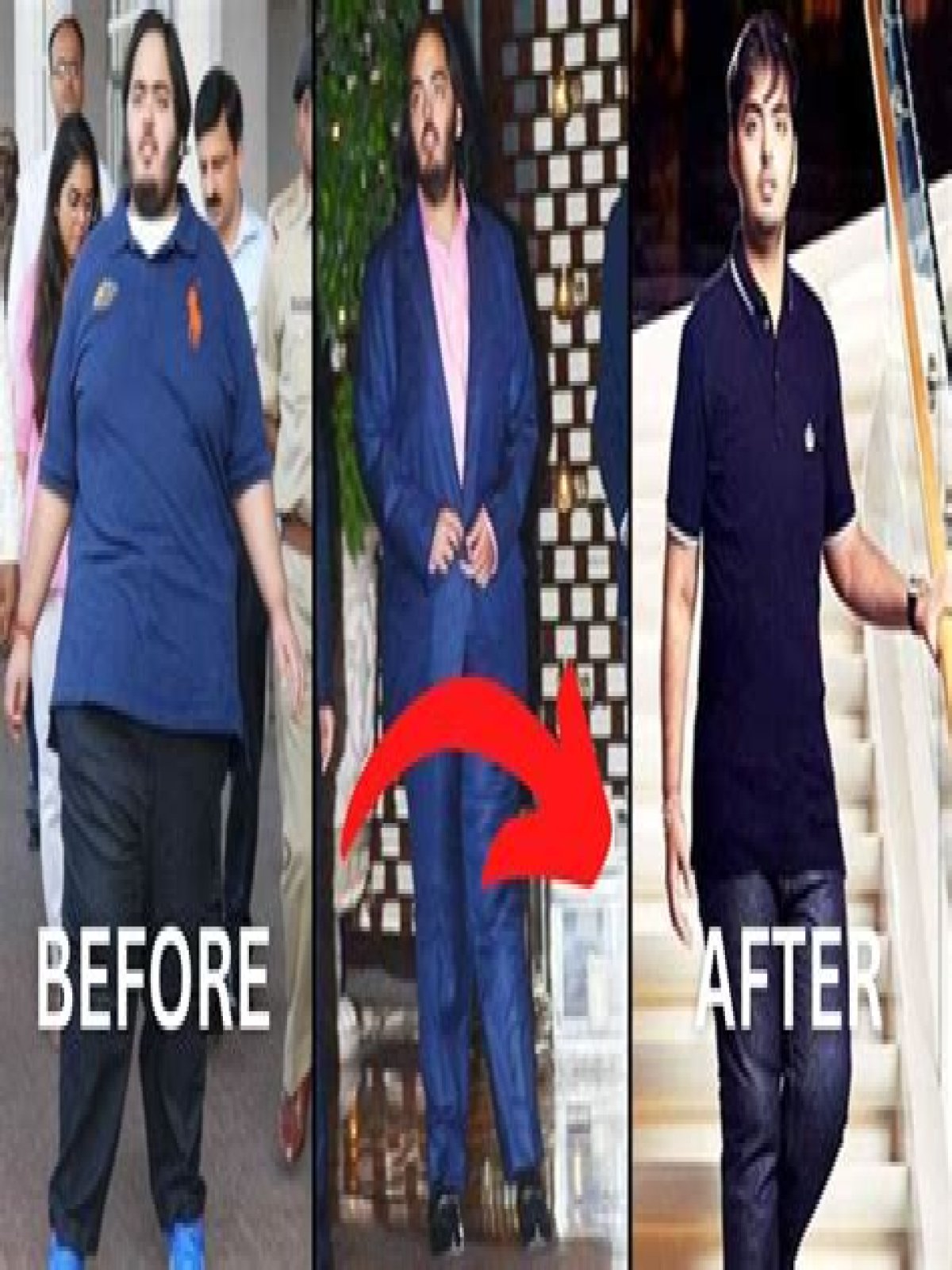 Anant Ambani's Health Journey: Is His Disease Curable Or Not?