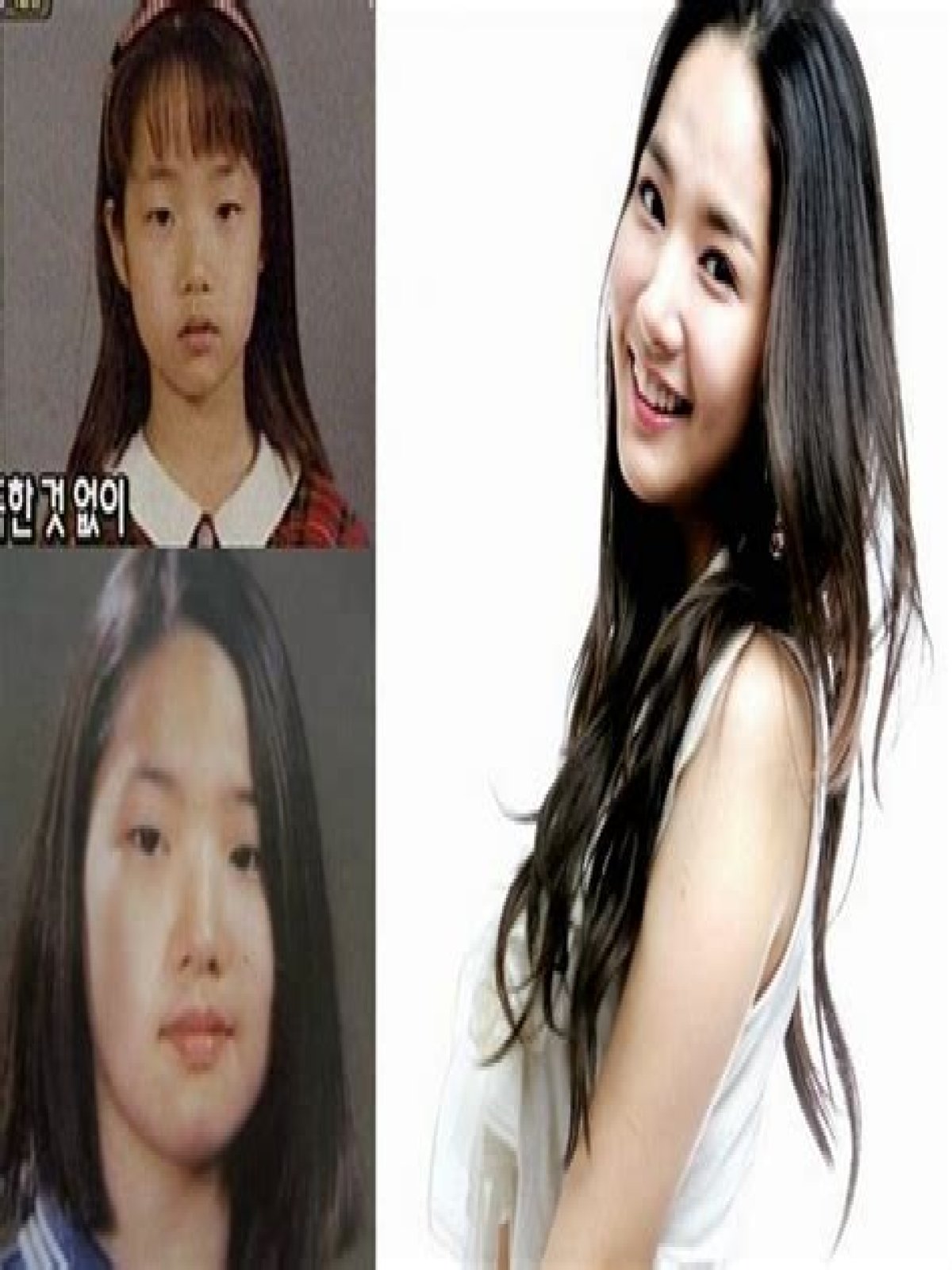 Park Min Young's Transformation: Uncovering The Journey Before Surgery